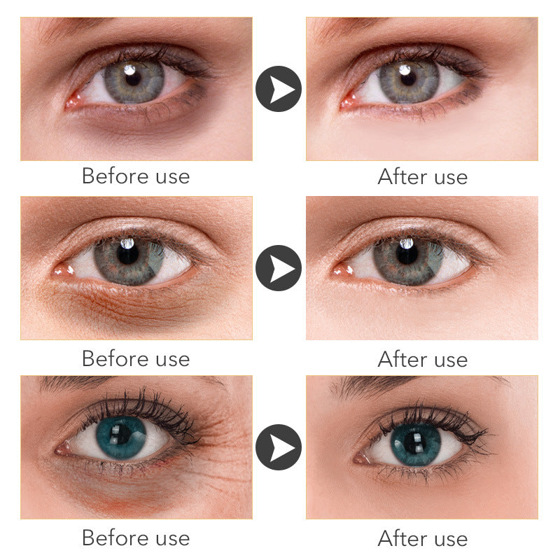 Hydrating Eye Cream 30ml – Anti-Dark Circles & Fine Lines Moisturizing Under Eye Treatment